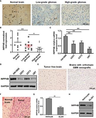 INPP4B inhibits glioma cell proliferation and immune escape via inhibition of the PI3K/AKT signaling pathway